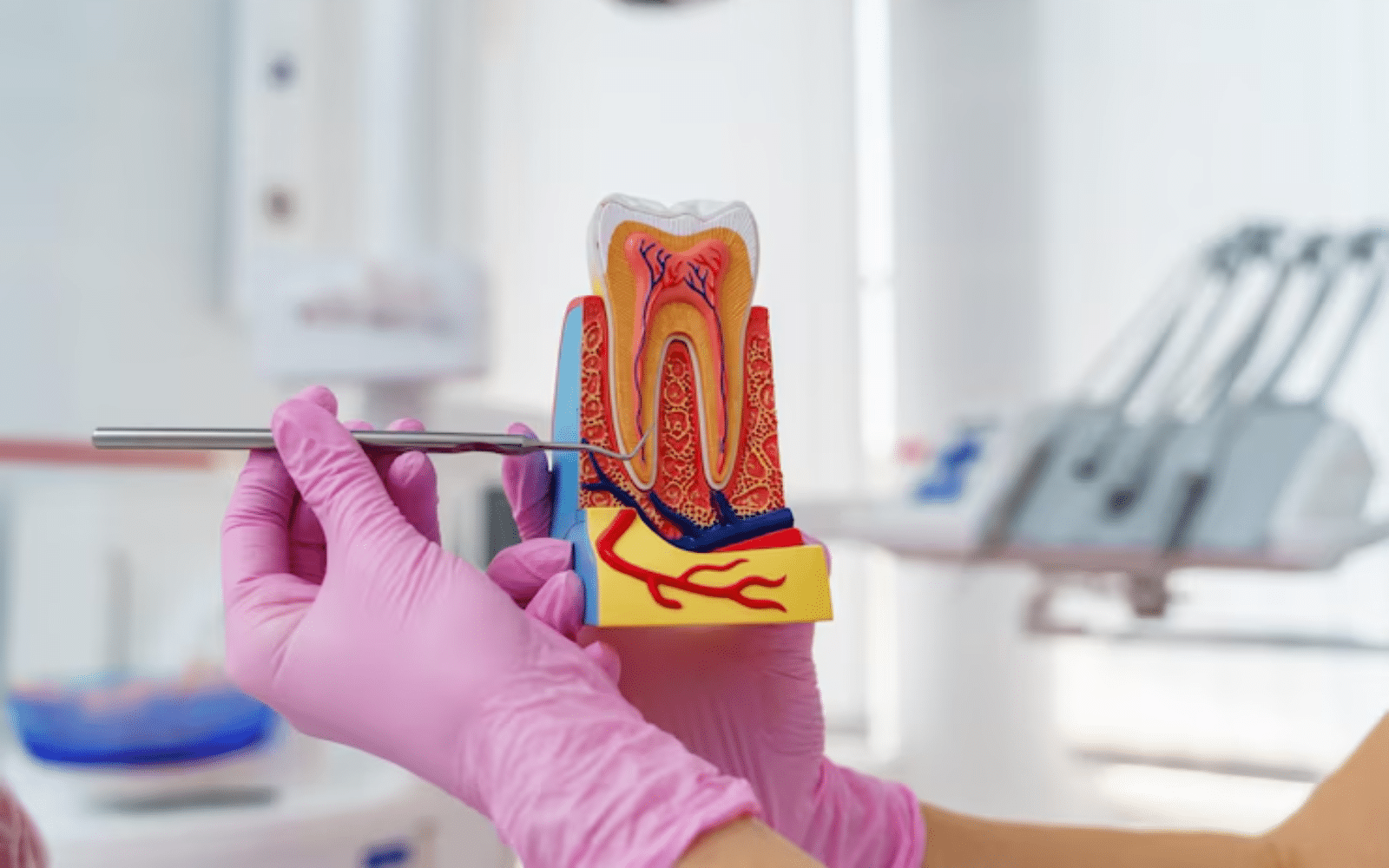 take to recover after a root canal treatment