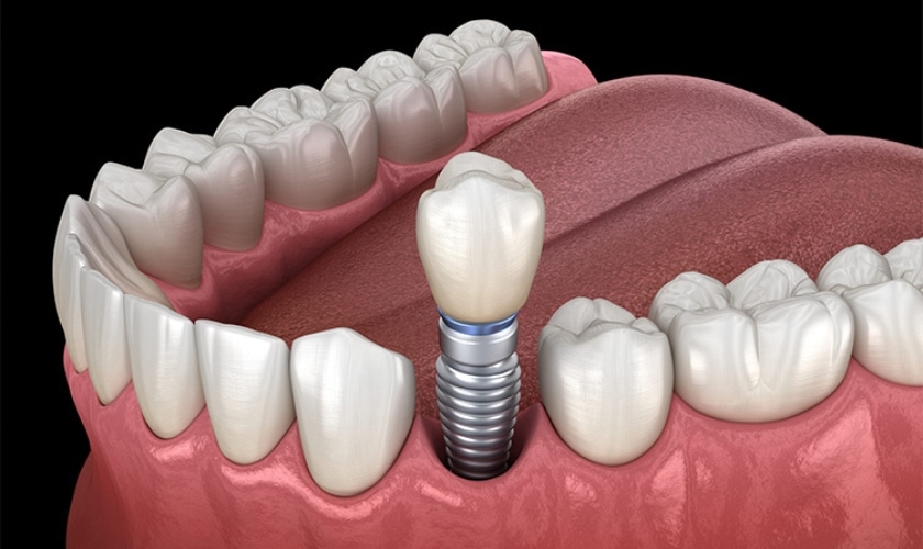 dentist in South Austin