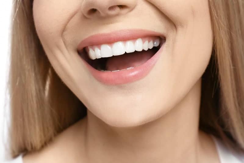 Close-up of bright, even teeth after cosmetic dental treatment