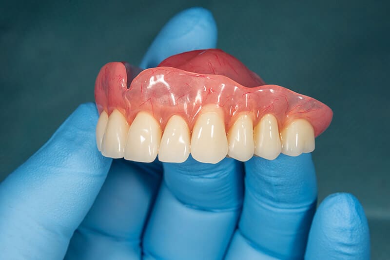 Implant supported dentures in South Austin TX held with gloved hands for tooth replacement treatment
