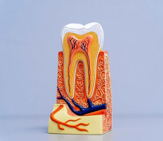 Tooth cross section diagram showing infected pulp and root canal treatment in a South Austin dental clinic